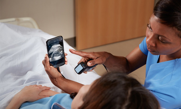 سونوگرافی با آیفون